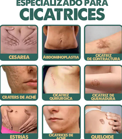 CicatriFix Regenera, suaviza y borra marcas y cicatrices