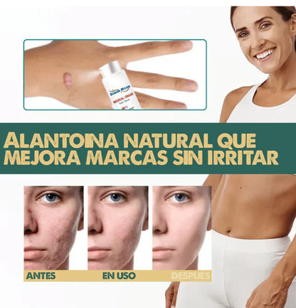 CicatriFix Regenera, suaviza y borra marcas y cicatrices