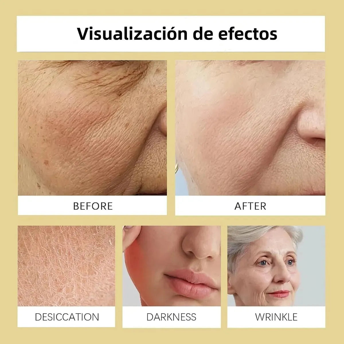 Crema Antiacné y Quitamanchas – Sebo de Res