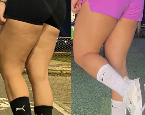 Gotu kola -Mejora la apariencia de la piel